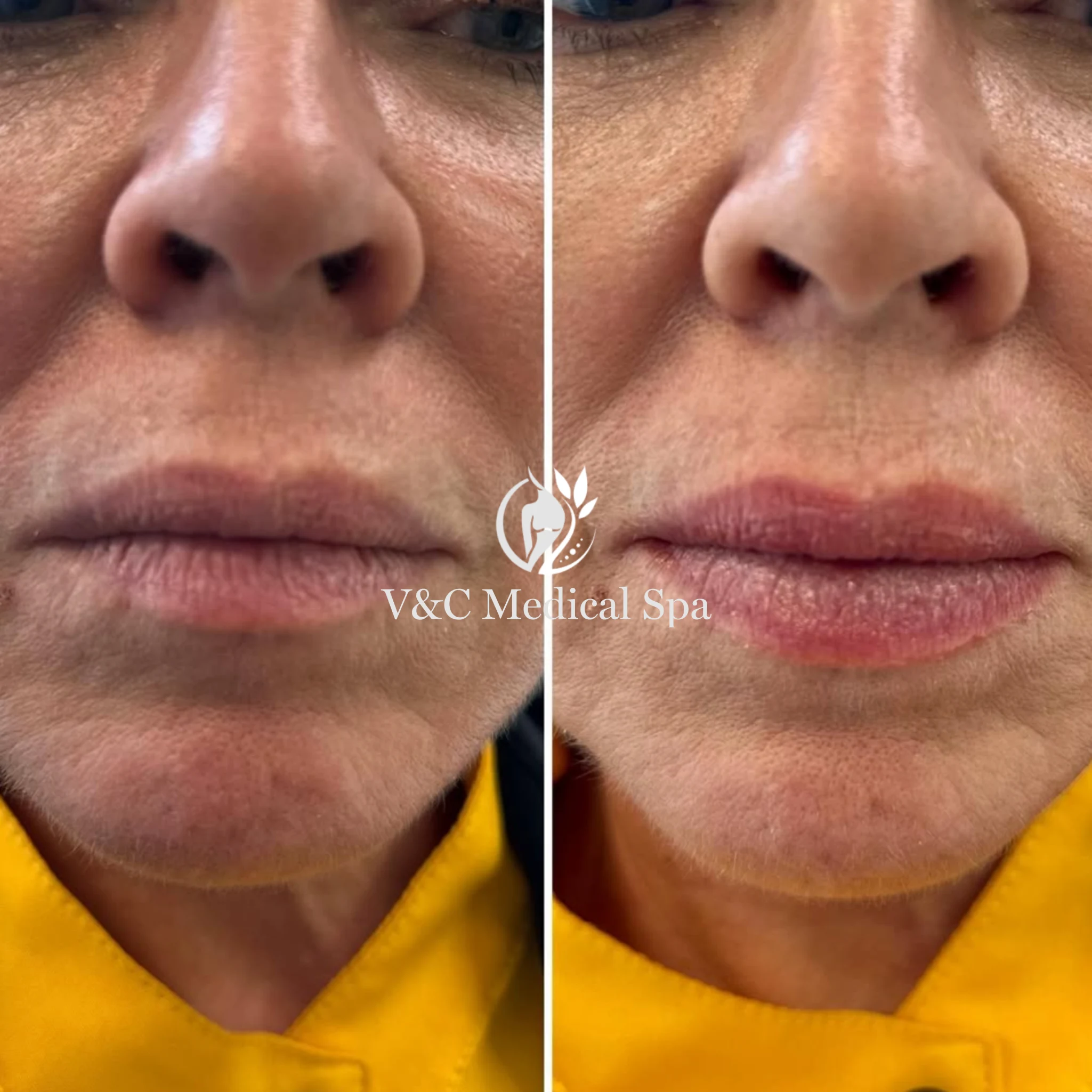 VC Medspa (15)