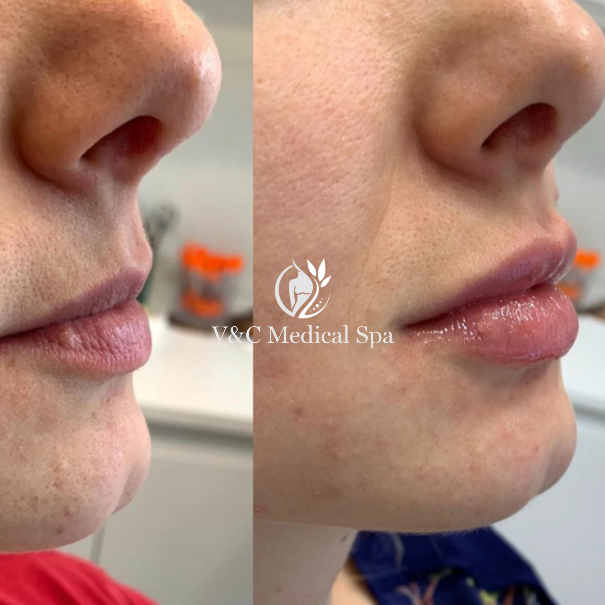 VC Medspa (9)